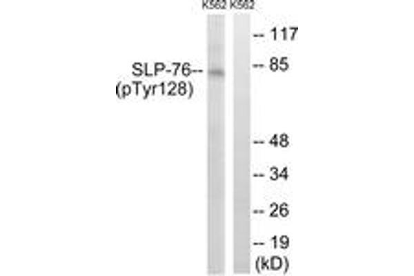 anti-Lymphocyte Cytosolic Protein 2 (SH2 Domain Containing Leukocyte Protein of 76kDa) (LCP2) (AA 94-143), (pTyr128) antibody
