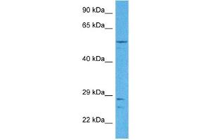 Image no. 2 for anti-Osteoactivin (GPNMB) (N-Term) antibody (ABIN2781895)