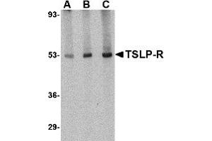 Image no. 1 for anti-Cytokine Receptor-Like Factor 2 (CRLF2) (Middle Region) antibody (ABIN1031149)