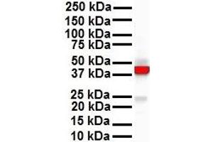 Image no. 5 for anti-Keratin 18 (KRT18) (N-Term) antibody (ABIN2778669)