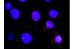 Image no. 2 for anti-Hemopoietic Cell Kinase (HCK) (AA 1-80) antibody (ABIN561237)
