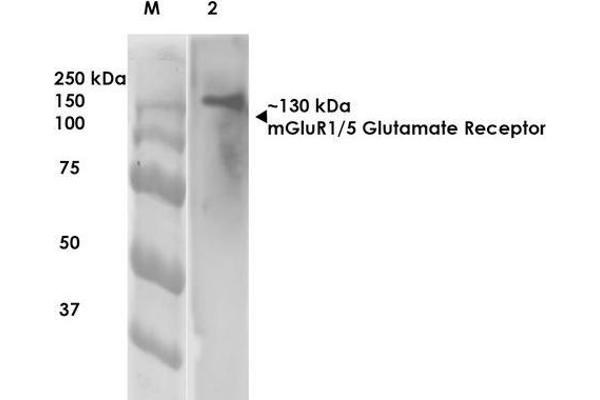 Metabotropic Glutamate Receptor 5 antibody  (AA 824-1203)