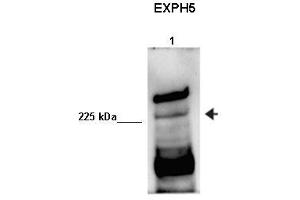 Image no. 2 for anti-Exophilin 5 (EXPH5) (Middle Region) antibody (ABIN2775414)