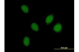 Image no. 2 for anti-PHD Finger Protein 16 (PHF16) (AA 1-823) antibody (ABIN523220)
