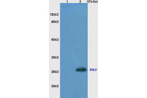 Image no. 4 for anti-B-Cell CLL/lymphoma 2 (BCL2) (AA 101-160) antibody (ABIN723920)