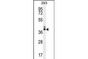 TMEM66 antibody  (N-Term)