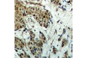 Image no. 2 for anti-MDS1 and EVI1 Complex Locus (MECOM) (full length) antibody (ABIN6005208)