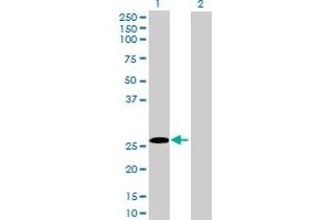 anti-Retinoic Acid Early Transcript 1G (RAET1G) (AA 1-213) antibody