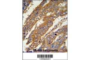Image no. 2 for anti-PAN3 Poly(A) Specific Ribonuclease Subunit Homolog (PAN3) (C-Term) antibody (ABIN2492235)