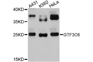 Image no. 1 for anti-General Transcription Factor IIIC, Polypeptide 6, alpha 35kDa (GTF3C6) antibody (ABIN6294075)