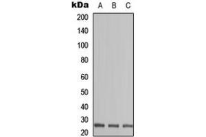 Image no. 2 for anti-Zinc Finger, CCHC Domain Containing 17 (ZCCHC17) (Center) antibody (ABIN2706880)