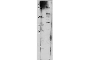 Image no. 1 for anti-ATP-Binding Cassette, Sub-Family B (MDR/TAP), Member 8 (ABCB8) (Internal Region) antibody (ABIN5596884)