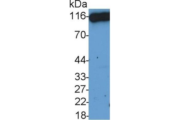 DPP4 抗体  (AA 29-178)