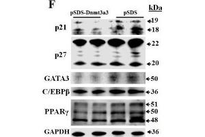 Image no. 1 for anti-Cyclin-Dependent Kinase Inhibitor 1B (p27, Kip1) (CDKN1B) (AA 150-198) antibody (ABIN672621)