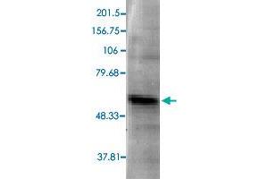 Image no. 2 for anti-Calcium Channel, Voltage-Dependent, beta 4 Subunit (CACNB4) antibody (ABIN5573605)