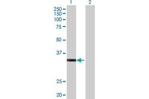 Image no. 1 for anti-Homeobox D1 (HOXD1) (AA 1-328) antibody (ABIN516660)