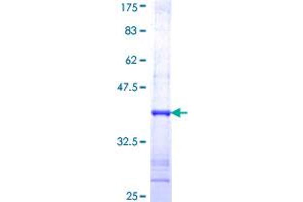 Nitric Oxide Synthase 2, Inducible (NOS2) (AA 685-794) protein (GST tag)