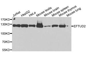Image no. 4 for anti-Elongation Factor Tu GTP Binding Domain Containing 2 (EFTUD2) antibody (ABIN6139968)