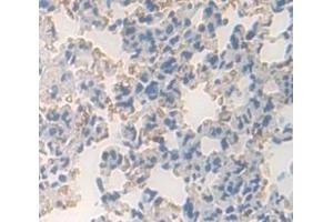 Image no. 2 for anti-Platelet-Derived Growth Factor Receptor-Like (PDGFRL) (AA 22-375) antibody (ABIN1869738)