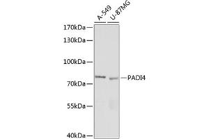 PAD4 Antikörper  (AA 374-550)