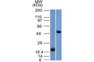 anti-Paired Box 8 (PAX8) (AA 60-261) antibody