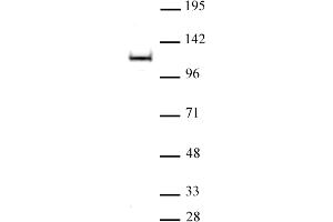 Image no. 1 for anti-Meningioma Expressed Antigen 5 (Hyaluronidase) (MGEA5) (N-Term) antibody (ABIN6972461)