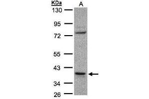 Image no. 1 for anti-Coiled-Coil Domain Containing 68 (CCDC68) (Center) antibody (ABIN2856453)