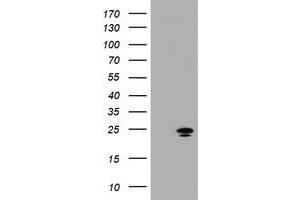 Image no. 1 for anti-Zinc Finger, AN1-Type Domain 5 (ZFAND5) antibody (ABIN1501814)
