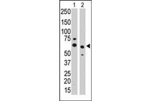 Image no. 1 for anti-Protein Phosphatase, Mg2+/Mn2+ Dependent, 1G (PPM1G) antibody (ABIN545040)