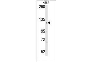 Image no. 2 for anti-LATS, Large Tumor Suppressor, Homolog 1 (Drosophila) (LATS1) (N-Term) antibody (ABIN359091)