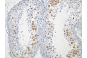 Image no. 1 for anti-MAD2 Mitotic Arrest Deficient-Like 1 (Yeast) (MAD2L1) antibody (ABIN108555)