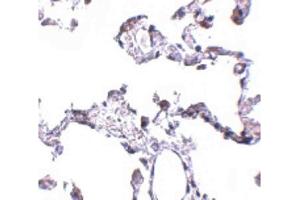 Image no. 2 for anti-CD81 (CD81) (N-Term) antibody (ABIN6657057)