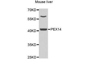 Image no. 6 for anti-Peroxisomal Biogenesis Factor 14 (PEX14) antibody (ABIN6145458)
