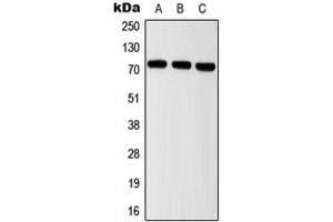 Image no. 1 for anti-Inter-alpha Globulin Inhibitor H2 Polypeptide (ITIH2) (Center) antibody (ABIN2706417)