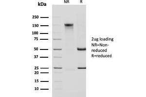 Image no. 1 for anti-Keratin 14 (KRT14) (AA 351-472) antibody (ABIN6939908)