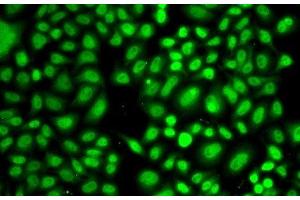Immunofluorescence analysis of A549 cells using CREB1 Polyclonal Antibody at dilution of 1:100 (40x lens).