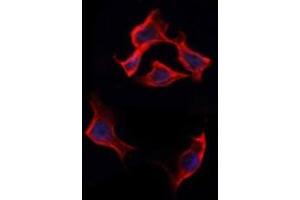 Image no. 4 for anti-Coxsackie Virus and Adenovirus Receptor (CXADR) (N-Term) antibody (ABIN6261118)