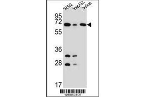 Image no. 1 for anti-Dihydrolipoyl Transacetylase (DLAT) (AA 579-607), (C-Term) antibody (ABIN651534)