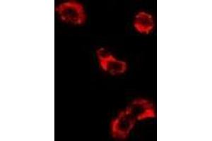 Image no. 3 for anti-Eukaryotic Translation Elongation Factor 1 delta (Guanine Nucleotide Exchange Protein) (EEF1D) (full length) antibody (ABIN6043408)