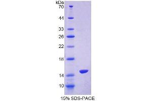 Image no. 1 for S100 Calcium Binding Protein Z (S100Z) (AA 1-99) protein (T7 tag,His tag) (ABIN6239256)