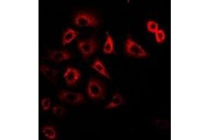 Immunofluorescent analysis of Tim17 staining in U2OS cells.