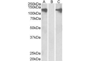 Image no. 2 for anti-Pumilio Homolog 2 (Drosophila) (PUM2) (Internal Region) antibody (ABIN185369)