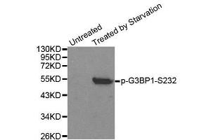 Image no. 1 for anti-GTPase Activating Protein (SH3 Domain) Binding Protein 1 (G3BP1) (pSer232) antibody (ABIN3020220)