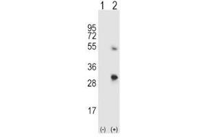 Image no. 1 for anti-Secreted Protein, Acidic, Cysteine-Rich (Osteonectin) (SPARC) (AA 224-251) antibody (ABIN3032525)