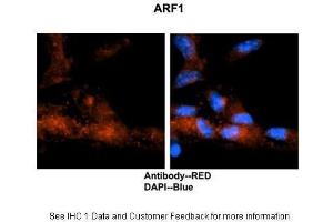 Image no. 6 for anti-ADP-Ribosylation Factor 1 (ARF1) (Middle Region) antibody (ABIN2783267)