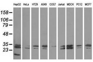 Image no. 2 for anti-Peroxisomal Trans-2-Enoyl-CoA Reductase (PECR) antibody (ABIN1500148)