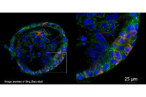 This immunofluorescence microscopy image shows localization of SARS-CoV-2 infection in human liver ductal organoids.