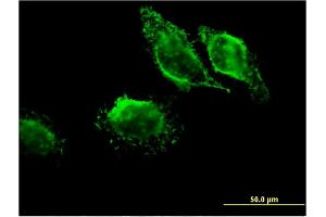 Image no. 3 for anti-Microtubule-Associated Protein, RP/EB Family, Member 3 (MAPRE3) (AA 125-218) antibody (ABIN524858)
