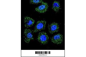 Image no. 3 for anti-Inhibitor of DNA Binding 1, Dominant Negative Helix-Loop-Helix Protein (ID1) (Center) antibody (ABIN2439754)