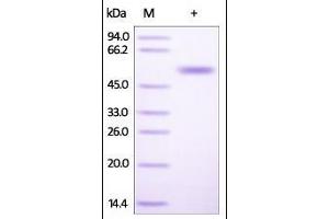 Human CD4, His Tag on SDS-PAGE under reducing (R) condition.
